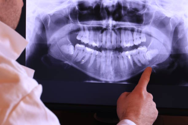 Best Emergency Tooth Extraction in Suitland, MD