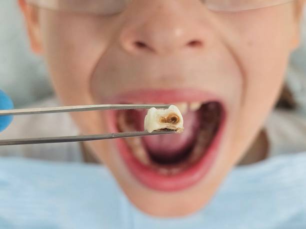 Best Emergency Dental Care for Trauma or Injury in Suitland, MD