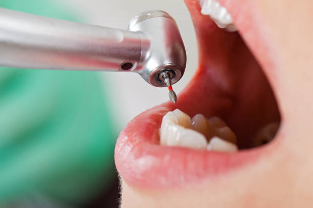 Best Pediatric Emergency Dentist in Suitland, MD